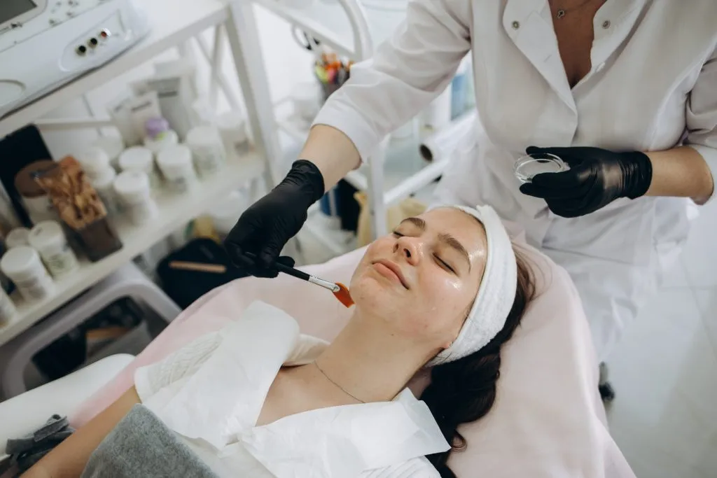Chemical Peel